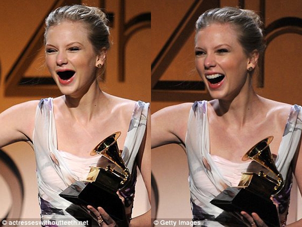 
	
	Taylor Swift với nụ cười "móm mém" khi răng không còn nữa.